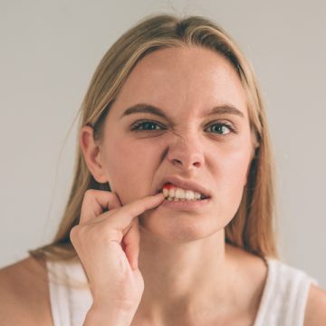 What To Do When You Have Bleeding Teeth?