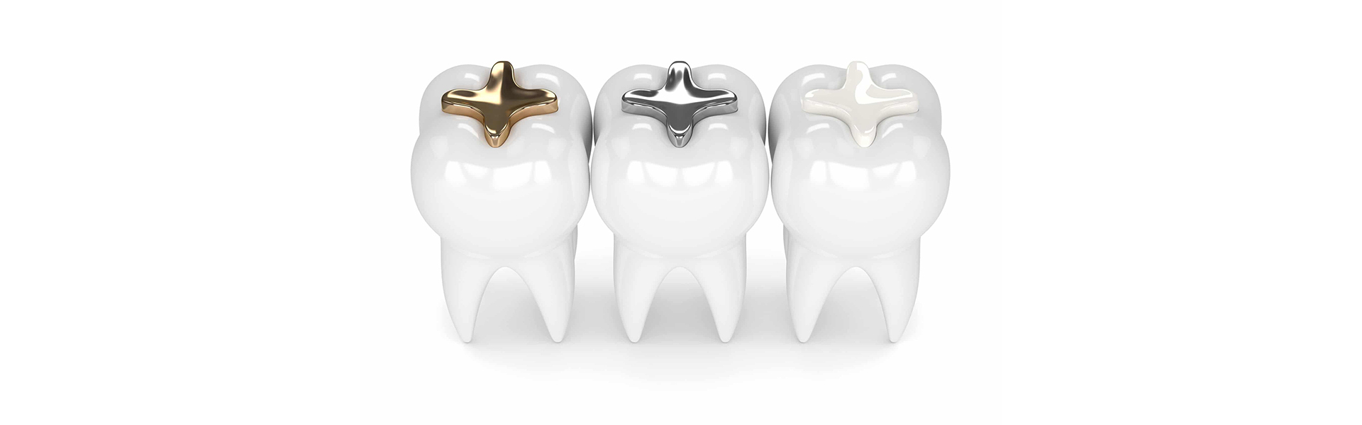Why Are Dental Fillings Necessary?